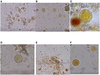 The Infection, Coinfection, and Abundance of Intestinal Protozoa Increase the Serum Levels of IFABP2 and TNF-α in Patients With Rheumatoid Arthritis